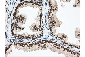 Immunohistochemical staining of paraffin-embedded Human Kidney tissue using anti-TACC3 mouse monoclonal antibody.