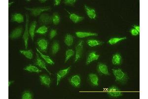Immunofluorescence of monoclonal antibody to UBE2G1 on HeLa cell.