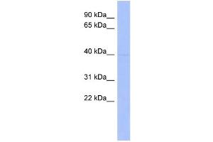 WB Suggested Anti-MEIS1 Antibody Titration:  0. (MEIS1 Antikörper  (Middle Region))