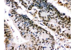 IHC analysis of XRCC4 using anti-XRCC4 antibody (ABIN3044561).