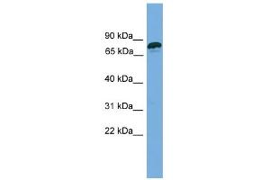 WB Suggested Anti-ZNF790 Antibody Titration:  0. (ZNF790 Antikörper  (N-Term))