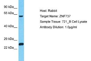 Host: Rabbit Target Name: ZNF737 Sample Type: 721_B Whole Cell lysates Antibody Dilution: 1. (ZNF737 Antikörper  (N-Term))