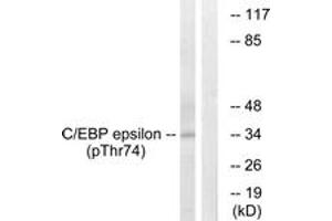 Western blot analysis of extracts from HuvEc cells treated with UV 15', using C/EBP-epsilon (Phospho-Thr74) Antibody. (CEBPE Antikörper  (pThr74))