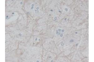 Detection of FGFR1 in Rat Spinal cord Tissue using Polyclonal Antibody to Fibroblast Growth Factor Receptor 1 (FGFR1) (FGFR1 Antikörper  (AA 22-376))