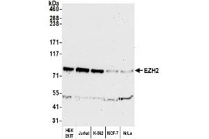 Western Blotting (WB) image for anti-Enhancer of Zeste Homolog 2 (EZH2) (AA 696-746) antibody (ABIN7450991) (EZH2 Antikörper  (AA 696-746))