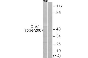 Western blot analysis of extracts from K562 cells, treated with Na3VO4 (0. (CHEK1 Antikörper  (pSer286))