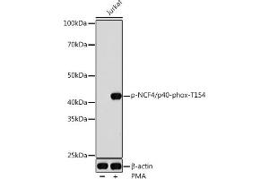 Western blot analysis of extracts of Jurkat cells, using Phospho-NCF4/p40-phox-T154 antibody (ABIN7268901) at 1:1000 dilution. (NCF4 Antikörper  (pThr154))