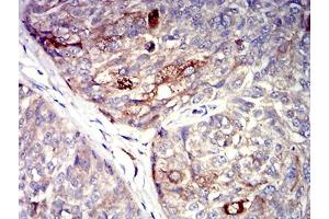 Immunohistochemistry (IHC) image for anti-Pyrimidinergic Receptor P2Y, G-Protein Coupled, 4 (P2RY4) antibody (ABIN5611350)