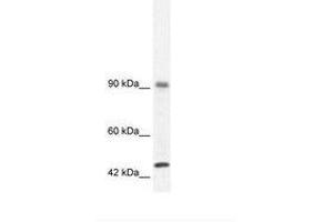 Image no. 3 for anti-RNA Binding Motif Protein 10 (RBM10) (AA 39-88) antibody (ABIN202954) (RBM10 Antikörper  (AA 39-88))