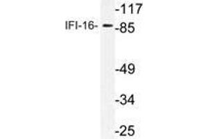 Western blot (WB) analysis of IFI-16 antibody in extracts from HepG2 cells. (IFI16 Antikörper)