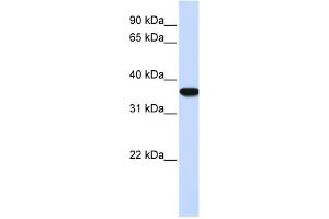 WB Suggested Anti-HMOX1 Antibody Titration: 0. (HMOX1 Antikörper  (N-Term))