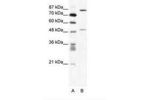 Image no. 1 for anti-Matrix Metallopeptidase 10 (Stromelysin 2) (MMP10) (N-Term) antibody (ABIN202622) (MMP10 Antikörper  (N-Term))