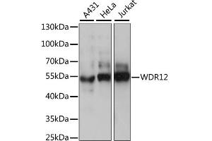 Western blot analysis of extracts of various cell lines, using WDR12 antibody. (WDR12 Antikörper)