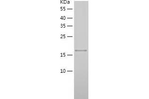 Western Blotting (WB) image for Noggin (NOG) (AA 28-232) protein (His tag) (ABIN7124188) (NOG Protein (AA 28-232) (His tag))