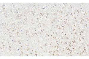Immunohistochemistry analysis of paraffin-embedded Rat brain using NOS1 Polyclonal Antibody at dilution of 1:300. (NOS1 Antikörper)