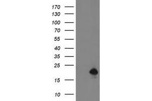 HEK293T cells were transfected with the pCMV6-ENTRY control (Left lane) or pCMV6-ENTRY DSTN (Right lane) cDNA for 48 hrs and lysed. (Destrin Antikörper)