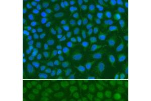 Immunofluorescence analysis of A549 cells using SSX5 Polyclonal Antibody (SSX5 Antikörper)