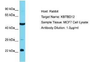 Host: Rabbit Target Name: KBTBD12 Sample Tissue: Human MCF7 Whole Cell Antibody Dilution: 1ug/ml (KBTBD12 Antikörper  (C-Term))