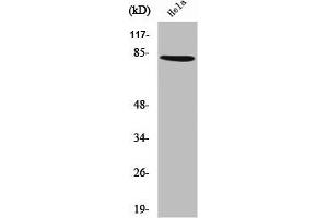 Western Blot analysis of HeLa cells using ZNF225 Polyclonal Antibody (ZNF225 Antikörper  (C-Term))