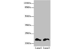 Western blot All lanes: FKBP11 antibody at 6 μg/mL Lane 1: Mouse spleen tissue Lane 2: Mouse liver tissue Secondary Goat polyclonal to rabbit IgG at 1/10000 dilution Predicted band size: 23, 16 kDa Observed band size: 23 kDa (FKBP11 Antikörper  (AA 28-154))