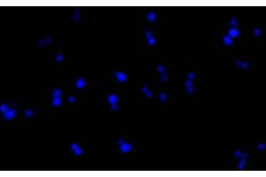 Immunofluorescence staining of Hela cells with(ABIN7153642)at 1:50, counter-stained with DAPI. (GAPDH Antikörper  (AA 2-335))