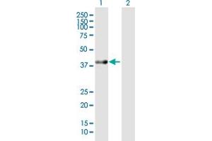 Western Blot analysis of ACAT2 expression in transfected 293T cell line by ACAT2 MaxPab polyclonal antibody. (ACAT2 Antikörper  (AA 1-397))