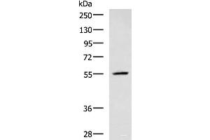 Western blot analysis of A549 cell lysate using CEP57 Polyclonal Antibody at dilution of 1:600 (CEP57 Antikörper)