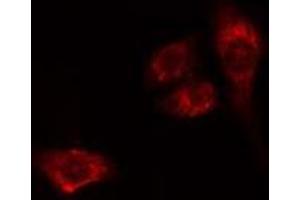 ABIN6275534 staining HeLa cells by IF/ICC. (PLK2 Antikörper  (Internal Region))