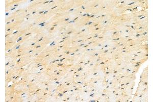 ABIN6264469 and ABIN6277231 at 1/100 staining Rat heart tissue by IHC-P. (PSMA2 Antikörper  (Internal Region))