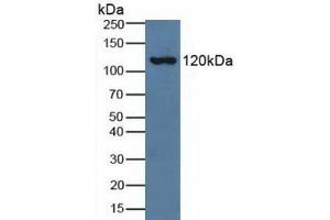 Detection of C3a in Human Serum using Polyclonal Antibody to Complement Component 3a (C3a) (C3a Antikörper  (AA 672-748))