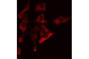 ABIN6268922 staining HepG2 cells by IF/ICC. (CYP26A1 Antikörper  (Internal Region))