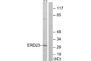 Western blot analysis of extracts from NIH/3T3 cells, using ERD23 antibody. (KDELR3 Antikörper  (Internal Region))