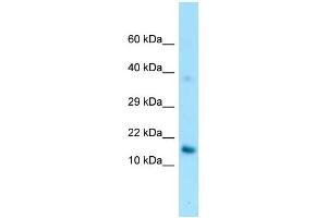 WB Suggested Anti-GPIHBP1 Antibody Titration: 1.