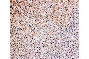 Immunohistochemistry (IHC) image for anti-Valosin Containing Protein (VCP) (C-Term) antibody (ABIN3029567)