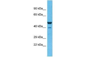 Host:  Rabbit  Target Name:  ZNF589  Sample Type:  Lung Tumor lysates  Antibody Dilution:  1. (ZNF589 Antikörper  (C-Term))