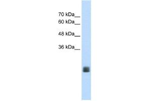 WB Suggested Anti-MGC33926 Antibody Titration:  1. (TMEM178 Antikörper  (Middle Region))