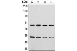 Western blot analysis of CD28 (pY218) expression in HeLa colchicine-treated (A), Jurkat (B), Raw264. (CD28 Antikörper  (C-Term, pTyr218))