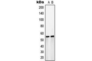 Western blot analysis of GLUT3 expression in COLO205 (A), HepG2 (B) whole cell lysates. (SLC2A3 Antikörper  (C-Term))