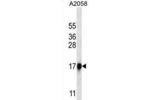 Western Blotting (WB) image for anti-Chymotrypsin-Like Elastase Family, Member 1 (CELA1) antibody (ABIN2999709) (CELA1 Antikörper)