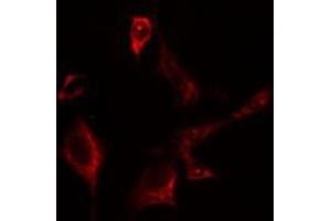 ABIN6275642 staining Hela cells by IF/ICC. (EIF2B3 Antikörper  (Internal Region))