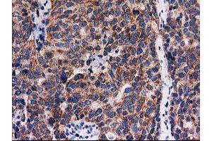 Image no. 4 for anti-Family with Sequence Similarity 127, Member C (FAM127C) antibody (ABIN1498197) (FAM127C Antikörper)