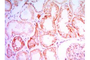 Immunohistochemical analysis of paraffin-embedded human kidney tissues using PTH1R mouse mAb with DAB staining. (PTH1R Antikörper)