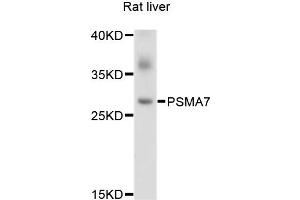 Western blot analysis of extracts of Rat liver cells, using PSMA7 antibody. (PSMA7 Antikörper)