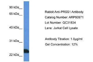 Western Blotting (WB) image for anti-Protease, serine, 1 (Trypsin 1) (PRSS1) (N-Term) antibody (ABIN2788638)
