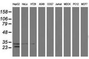 Western blot analysis of extracts (35 µg) from 9 different cell lines by using anti-GSTT2 monoclonal antibody. (GSTT2 Antikörper)