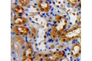 IHC-P analysis of Kidney tissue, with DAB staining. (NR3C2 Antikörper  (AA 739-984))