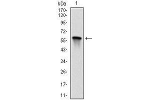 Western blot analysis using MAP2K7 mAb against human MAP2K7 (AA: 7-178) recombinant protein.
