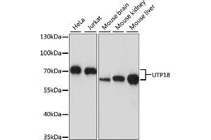 Western blot analysis of extracts of various cell lines, using UTP18 antibody (ABIN7271359) at 1:1000 dilution. (UTP18 Antikörper  (AA 70-260))