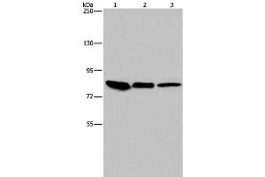 Western Blot analysis of Mouse skin tissue, HUVEC and Hela cell using Catenin gamma Polyclonal Antibody at dilution of 1:850 (JUP Antikörper)