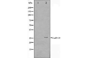 Western blot analysis on LOVO cell lysate using Claudin 10 Antibody,The lane on the left is treated with the antigen-specific peptide. (CLDN10 Antikörper  (C-Term))